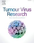 Tumour Virus Research