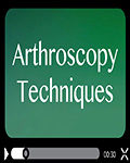 Arthroscopy Techniques