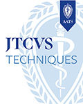 JTCVS Techniques