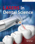 Lasers in Dental Science