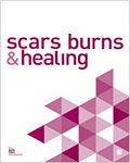Scars, Burns & Healing